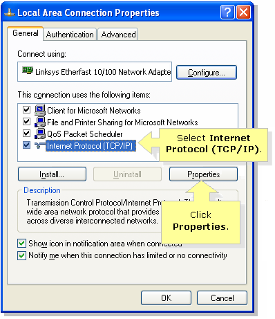 Windows XP Local Area Connection Properties
